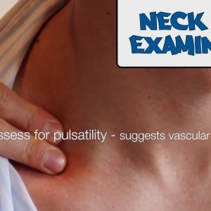 Neck lump examination - OSCE Guide (New Version)