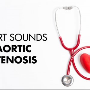 Aortic Stenosis - Heart Sounds - MEDZCOOL