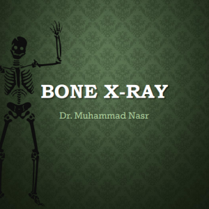 x-ray دكتور محمد نصر.png